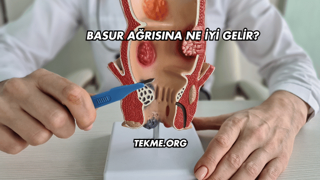 Basur Ağrısına Ne İyi Gelir?