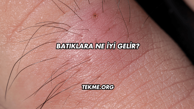 Batıklara Ne İyi Gelir?