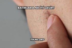 Batıklara Ne İyi Gelir?