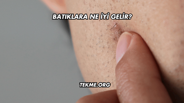 Batıklara Ne İyi Gelir?