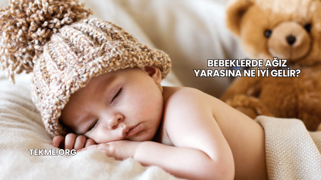 Bebeklerde Ağız Yarasına Ne İyi Gelir?