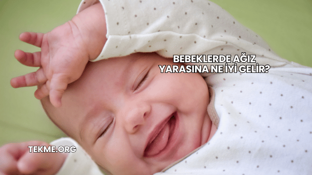 Bebeklerde Ağız Yarasına Ne İyi Gelir?