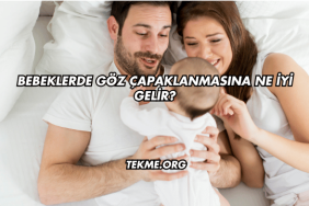 Bebeklerde Göz Çapaklanmasına Ne İyi Gelir?
