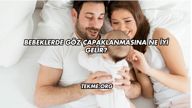 Bebeklerde Göz Çapaklanmasına Ne İyi Gelir?
