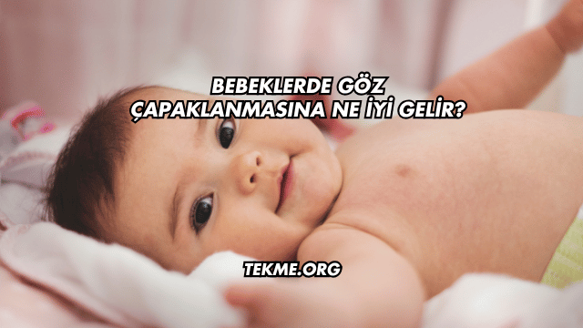 Bebeklerde Göz Çapaklanmasına Ne İyi Gelir?