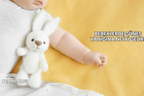 Bebeklerde Güneş Yanığına Ne İyi Gelir?