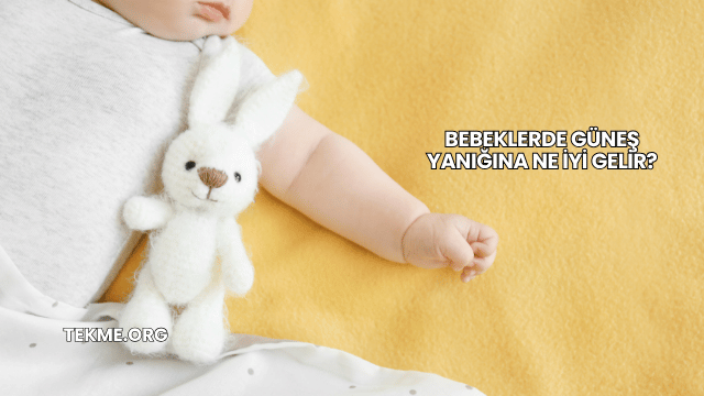 Bebeklerde Güneş Yanığına Ne İyi Gelir?