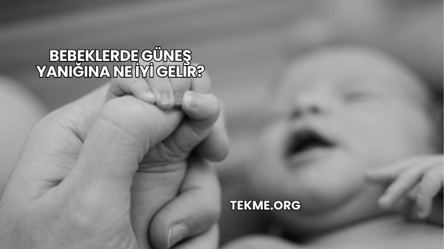 Bebeklerde Güneş Yanığına Ne İyi Gelir?