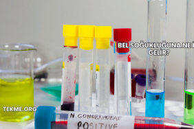 Bel Soğukluğuna Ne İyi Gelir?