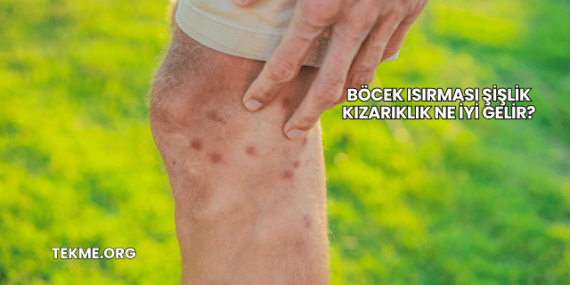 Böcek Isırması Şişlik Kızarıklık Ne İyi Gelir?
