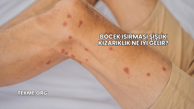 Böcek Isırması Şişlik Kızarıklık Ne İyi Gelir?
