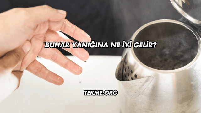 Buhar Yanığına Ne İyi Gelir?