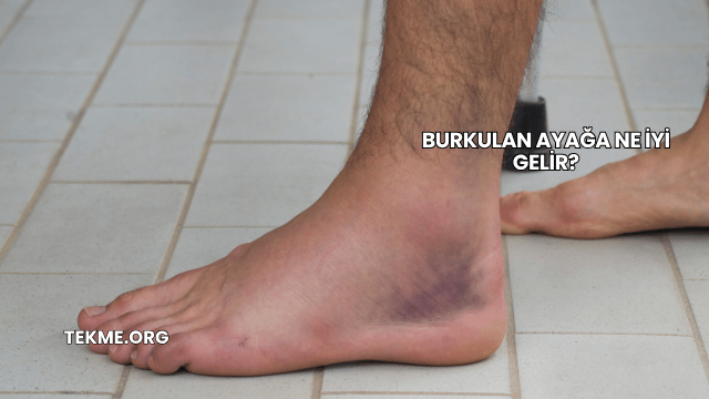 Burkulan Ayağa Ne İyi Gelir?