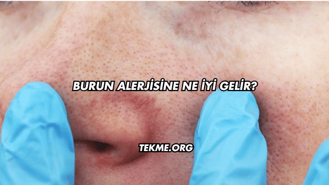 Burun Alerjisine Ne İyi Gelir?