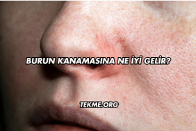 Burun Kanamasına Ne İyi Gelir?