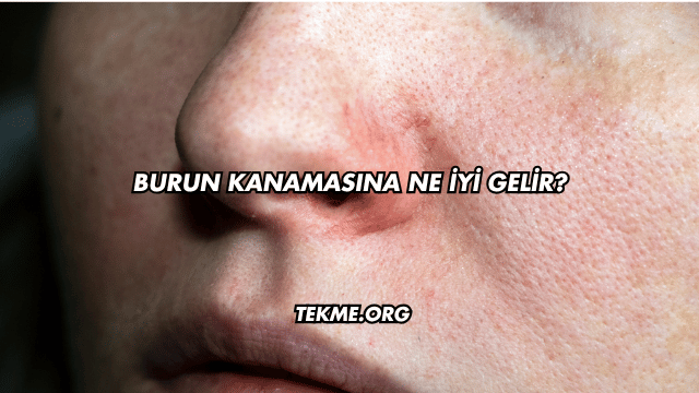 Burun Kanamasına Ne İyi Gelir?