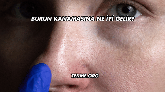 Burun Kanamasına Ne İyi Gelir?