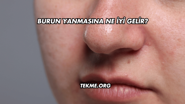 Burun Yanmasına Ne İyi Gelir?