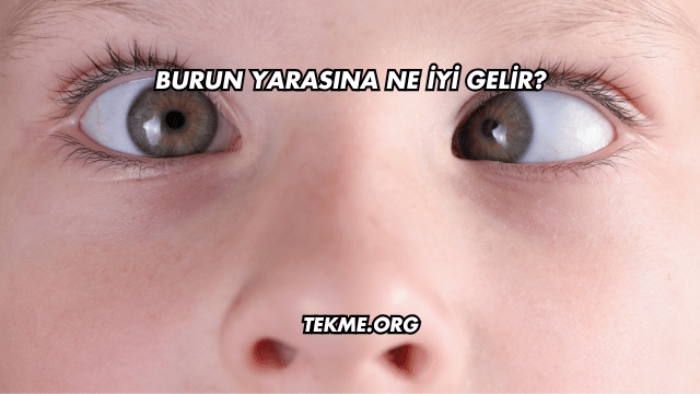 Burun Yarasına Ne İyi Gelir?