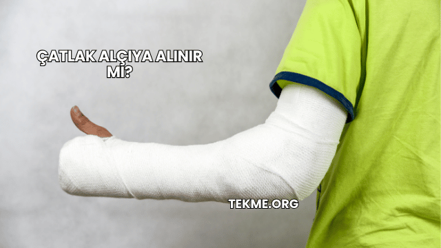 Çatlak Alçıya Alınır mı?