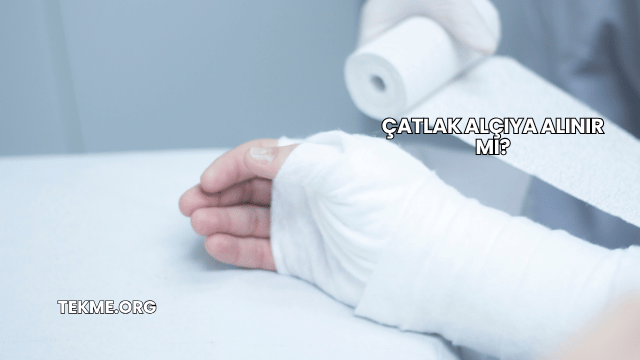 Çatlak Alçıya Alınır mı?