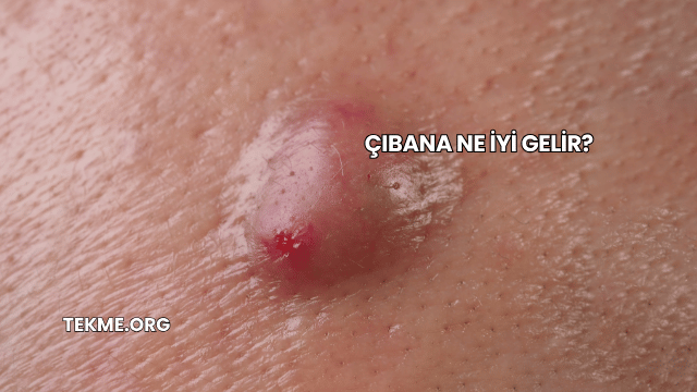 Çıbana Ne İyi Gelir?