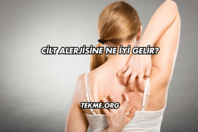 Cilt Alerjisine Ne İyi Gelir?