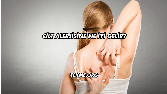 Cilt Alerjisine Ne İyi Gelir?