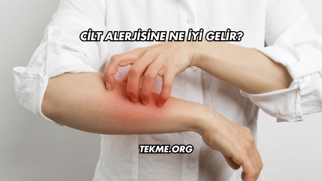 Cilt Alerjisine Ne İyi Gelir?