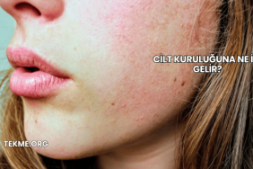 Cilt Kuruluğuna Ne İyi Gelir?