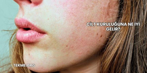 Cilt Kuruluğuna Ne İyi Gelir?