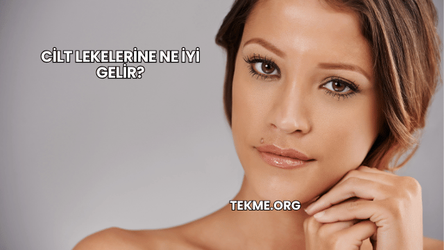 Cilt Lekelerine Ne İyi Gelir?