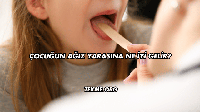 Çocuğun Ağız Yarasına Ne İyi Gelir?