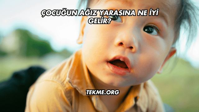 Çocuğun Ağız Yarasına Ne İyi Gelir?