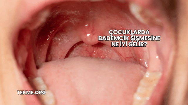 Çocuklarda Bademcik Şişmesine Ne İyi Gelir?