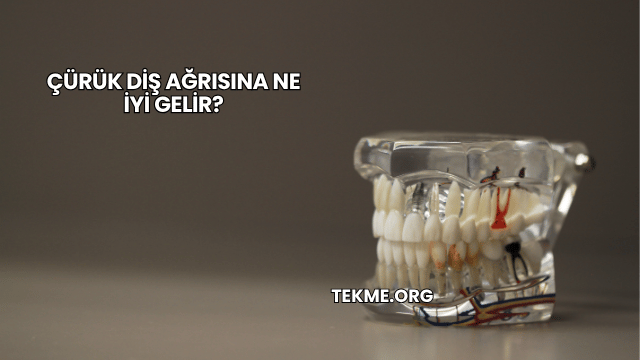 Çürük Diş Ağrısına Ne İyi Gelir?