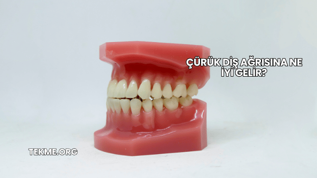 Çürük Diş Ağrısına Ne İyi Gelir?