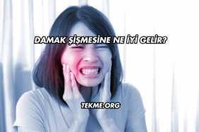 Damak Şişmesine Ne İyi Gelir?