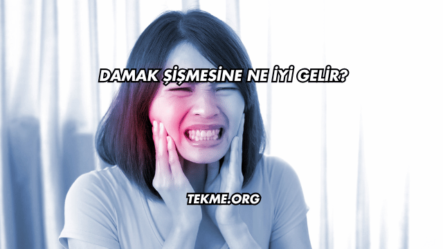 Damak Şişmesine Ne İyi Gelir?