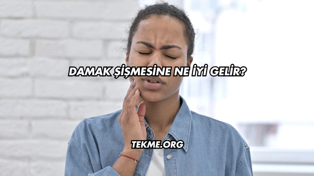 Damak Şişmesine Ne İyi Gelir?