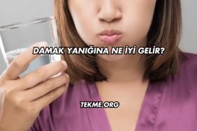 Damak Yanığına Ne İyi Gelir?