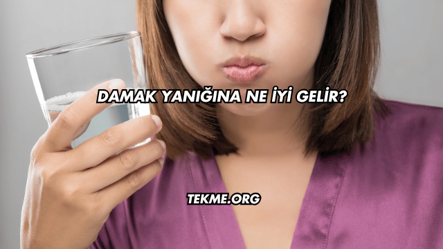 Damak Yanığına Ne İyi Gelir?