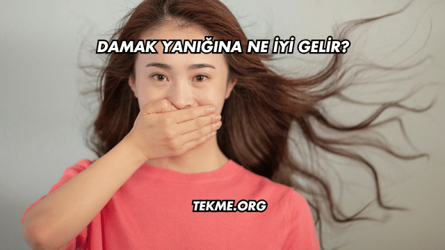 Damak Yanığına Ne İyi Gelir?