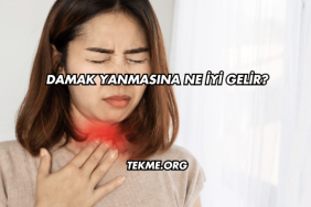 Damak Yanmasına Ne İyi Gelir?