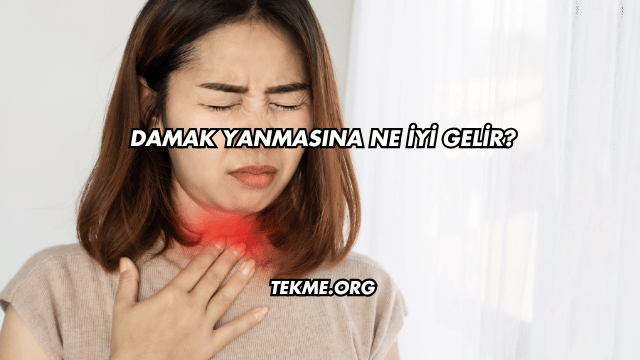 Damak Yanmasına Ne İyi Gelir?