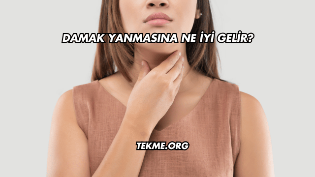 Damak Yanmasına Ne İyi Gelir?