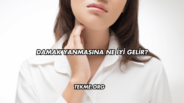 Damak Yanmasına Ne İyi Gelir?