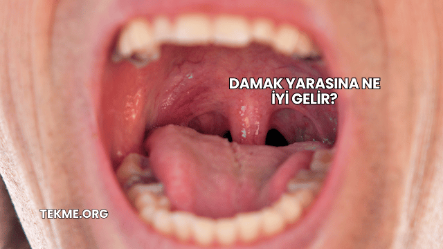 Damak Yarasına Ne İyi Gelir?