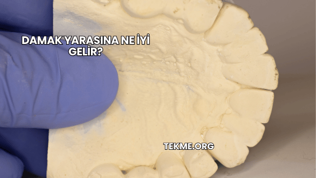 Damak Yarasına Ne İyi Gelir?
