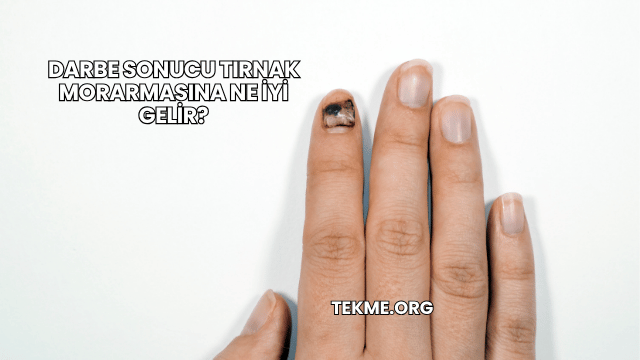 Darbe Sonucu Tırnak Morarmasına Ne İyi Gelir?
